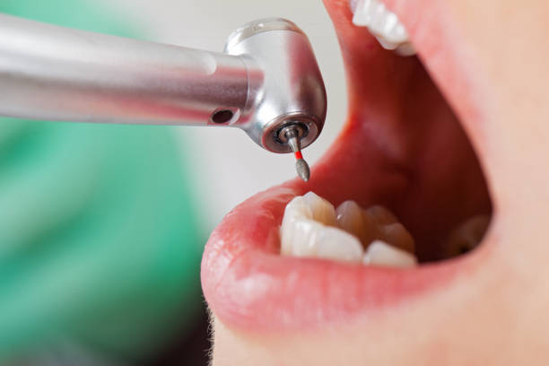 Best Walk-In Emergency Dentist in Jellico, TN